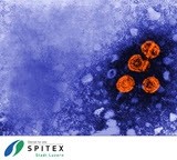Wichtig Erreger in der Spitex-Pflege - Hepatitis-Viren - rissip Onlinetraining