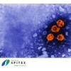 Wichtige Erreger in der Spitex-Pflege - Hepatitis-Viren