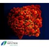 Wichtige Erreger in der Spitex-Pflege - HI-Virus (AIDS)