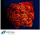 Wichtig Erreger in der Spitex-Pflege - HIV - rissip Onlinetraining