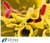 Wichtig Erreger in der Spitex-Pflege - Salmonellen - rissip Onlinetraining