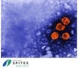 Wichtig Erreger in der Spitex-Pflege - Hepatitis-Viren - rissip Onlinetraining